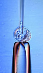 Implante de células madre